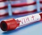 Científicos logran eliminar el virus del VIH