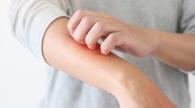 Alertan por enfermedades de la piel y gastroenteritis